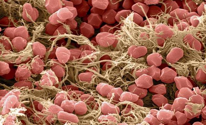 Türkiye'nin ilk milli ilacı, dünyanın yarasını saracak