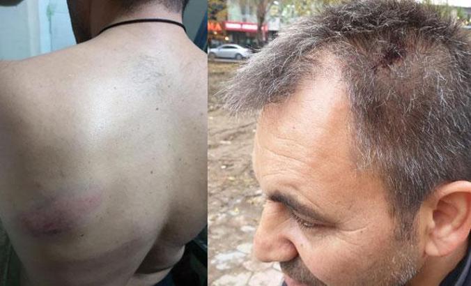 Valilikten, yerel gazete sahibine saldırıya ilişkin açıklama