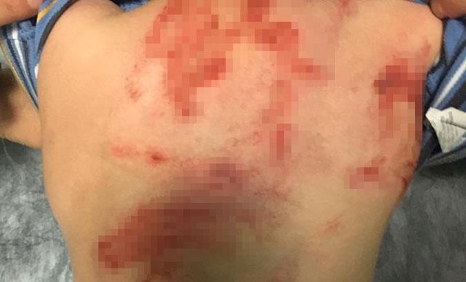 Küçük çocuğu darp ve cinsel istismar iddiasına tutuklama