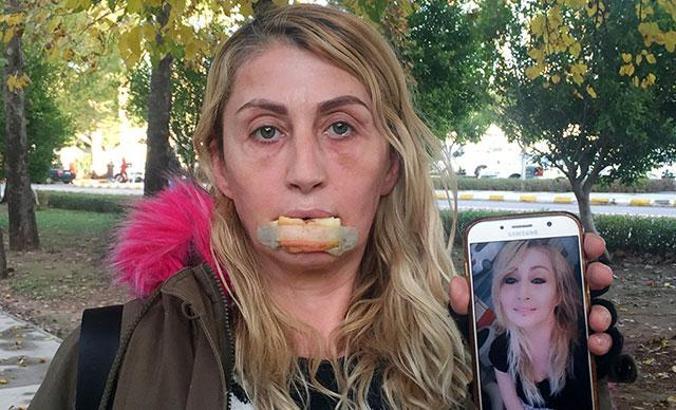 'Estetik cerrahiyi, plastik cerrahlar yapmalı'