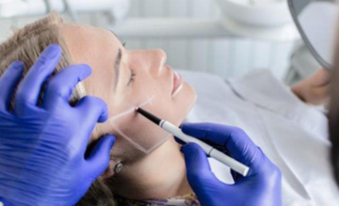 Merdiven altı estetik yüz anatomisini bozabilir