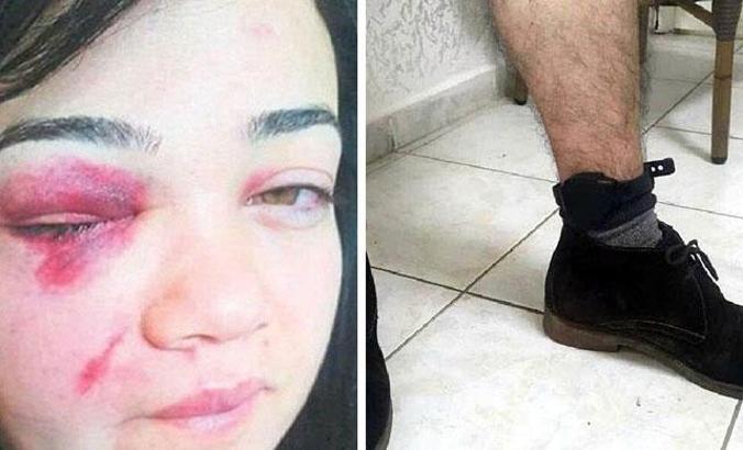 Zeliha'nın eski eşine takılan elektronik kelepçe bozuk çıktı