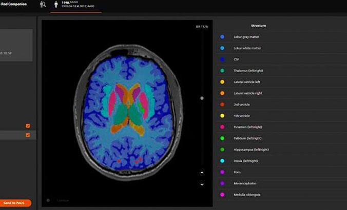 ''Yapay zeka MR ile birleşince hastalık teşhisleri kolaylaştı''