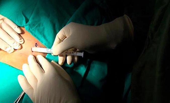 Madde bağımlıları 'çip tedavisi' ile bağımlılıktan kurtuluyor