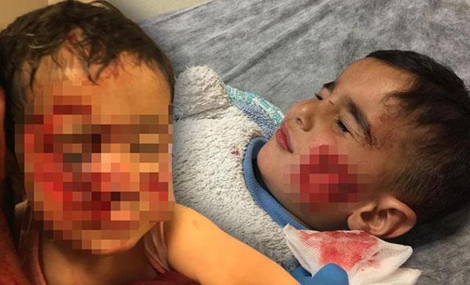 Viranşehir'de köpek saldırısına uğrayan küçük Davut, kurtarılamadı