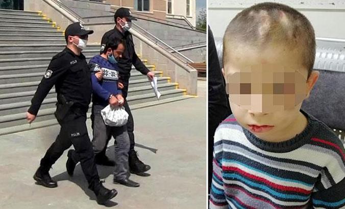 Üvey babasının işkencesi nedeniyle korumaya alınan çocuk: Arkadaş edinmek istiyorum