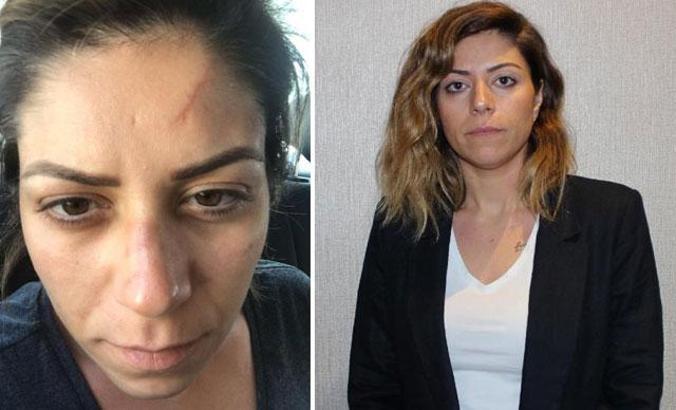 Boşandığı eşinden şiddet gören avukat: Tutuklama tedbiri ben öldükten sonra mı uygulanacak?