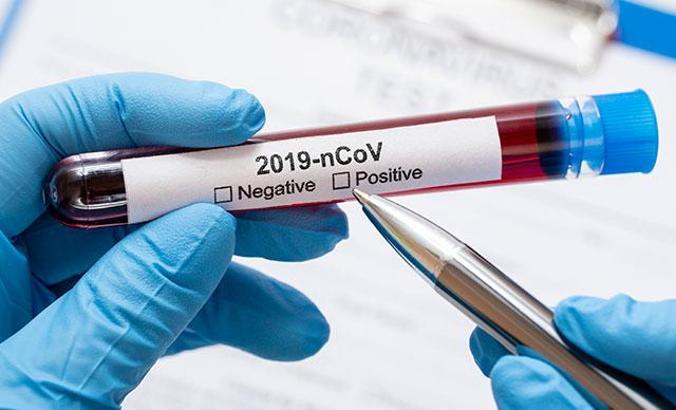 Silivri Cezaevi'nde bir kişi koronavirüsten hayatını kaybetti