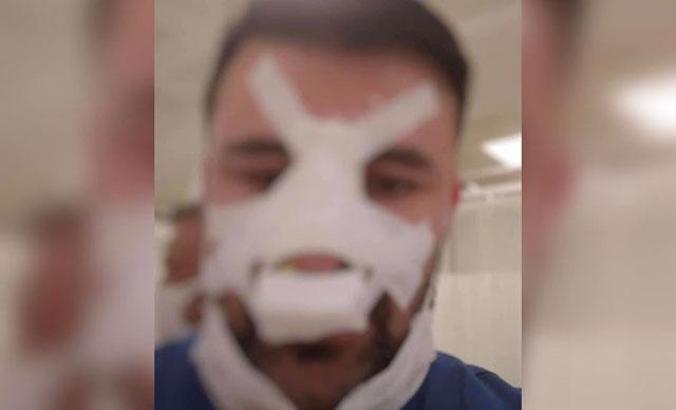 Bayram günü sağlık çalışanının burnunu kırdı, serbest kaldı