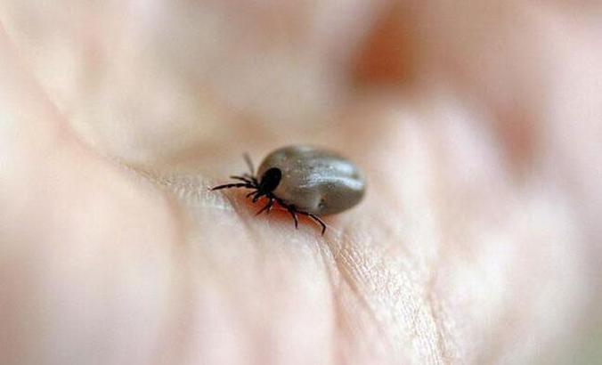 Yozgat'ta kenenin ısırdığı çiftçi öldü