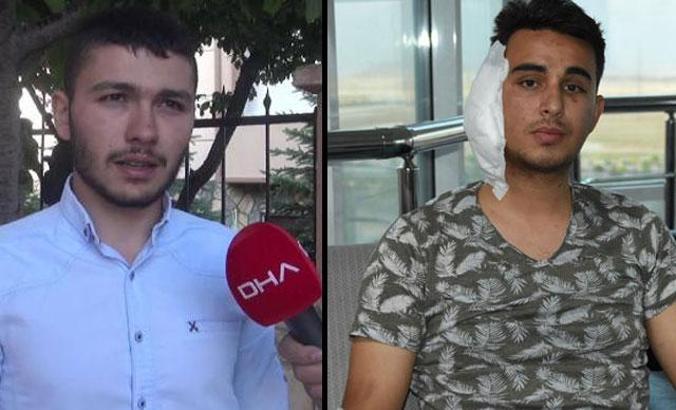 Postacının kulağını ısırarak koparmıştı... Tutuklandı