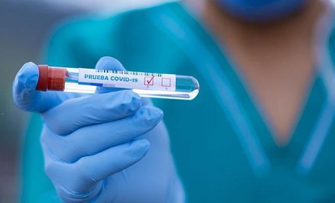 Dünya genelinde koronavirüs bilançosu: Can kaybı 485 bin 160’a yükseldi