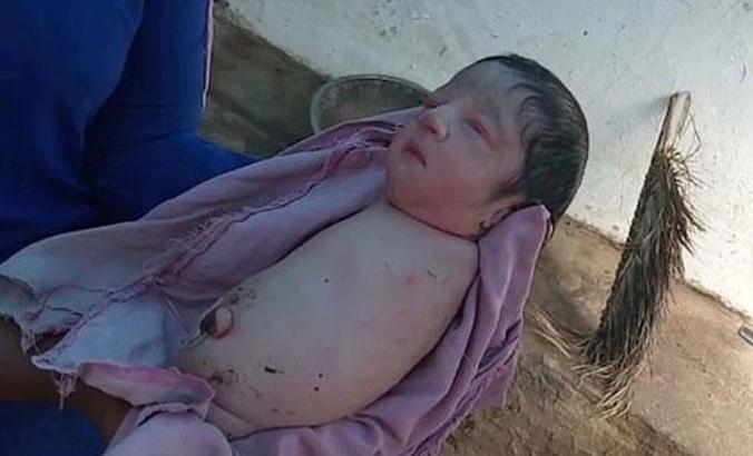 Hindistan’da kolları ve bacakları olmadan doğan bebek şaşkınlığı