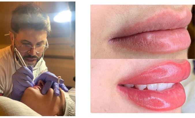 Güzellik koçu Sinan İslam Yılmaz’dan dudakta oluşan pigment kaybı için öneriler