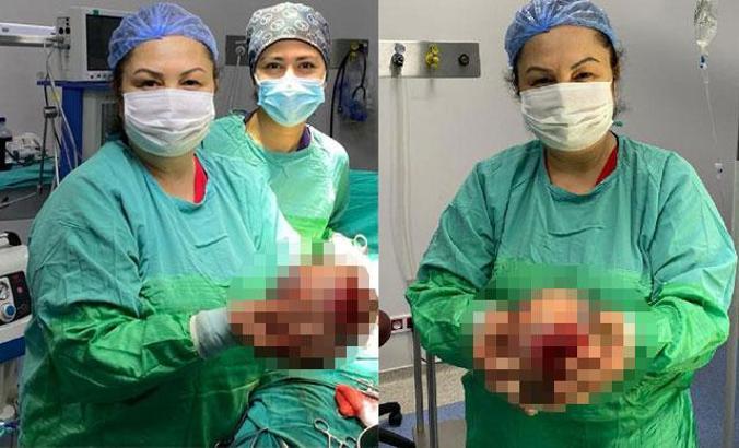 Rahminden 1,5 kiloluk kist çıktı