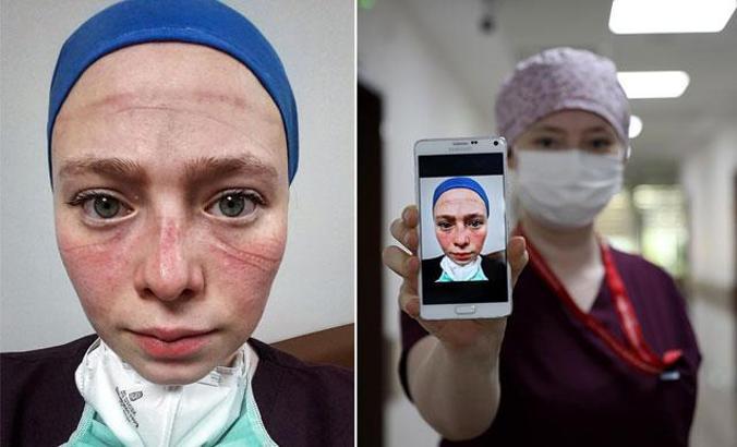 Yoğun bakım çalışma zorluğu yüzüne yansıyan Seher hemşireye övgü