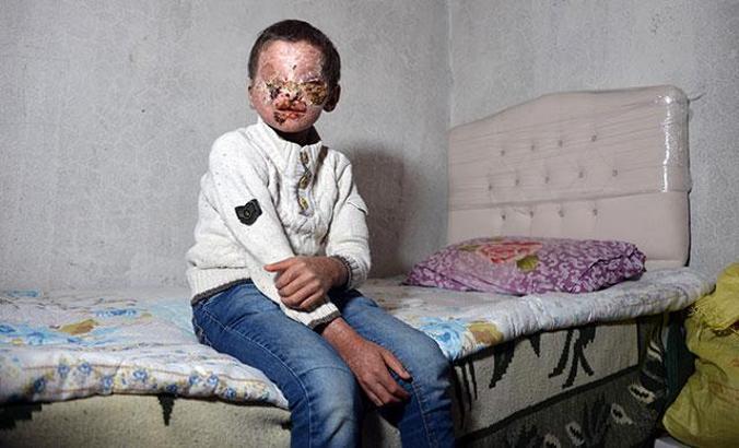 DHA'nın sesini duyurduğu Salih'in yüzü iyileşmeye başladı