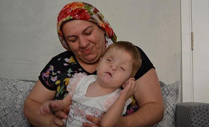 Fraser sendromlu Sevgi Hira, anne sevgisiyle yaşama tutunuyor