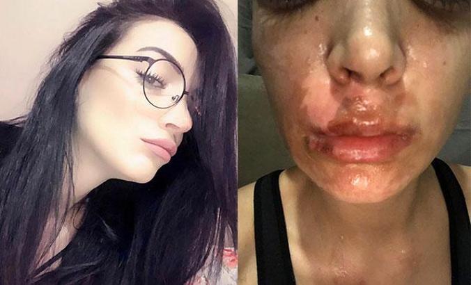 ''Yüzüme lavabo açıcı patladı'' iddiası... 1,5 milyon liralık tazminat davası açtı