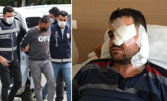 Avukatı bıçakla saldırıp kör eden peruklu saldırgan, boşanma davasındaki müvekkilin kocası çıktı