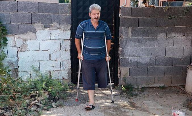 Bacağını kaybetti, gençleri uyardı: Benden ibret alın ve sigarayı bırakın