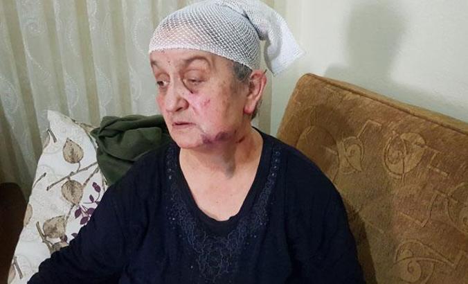 Evine giren gaspçıdan 'ölü' taklidi yaparak, kurtuldu