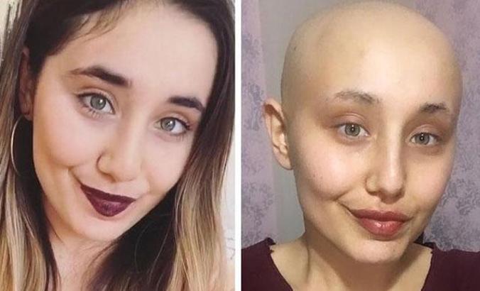 Kanser tedavisi gören Ayyüce, yaşamını yitirdi