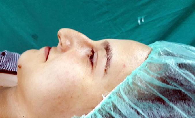 Karadeniz’de burun estetiğine ilgi, salgın döneminde de sürüyor