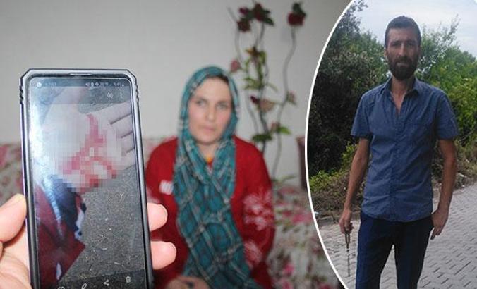 Röportajda eski eşinden şiddet gördüğünü anlattı; saatler sonra morga gidip cesedini teşhis etti