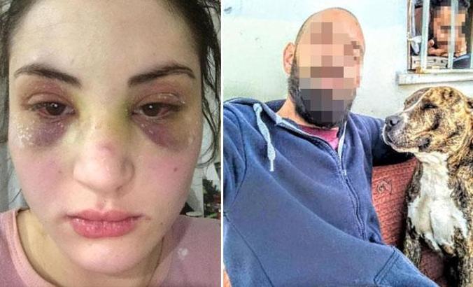 Kaçarak evlendiği kocası, hayatını zindana çevirdi, köpeklerin önüne atmakla tehdit etti