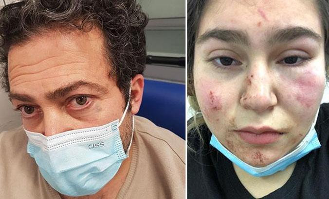 Almanya’da polisin kızıyla birlikte dövdüğü Türk konuştu