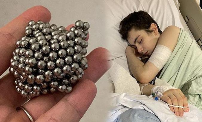 İngiltere’de çocuğun midesinden 54 adet mıknatıslı bilye çıktı