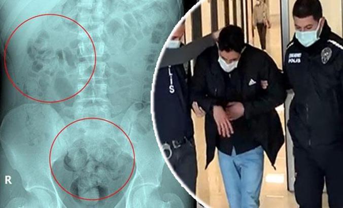 Otogarda rahatsızlanan İranlının midesinde 890 gram uyuşturucu çıktı