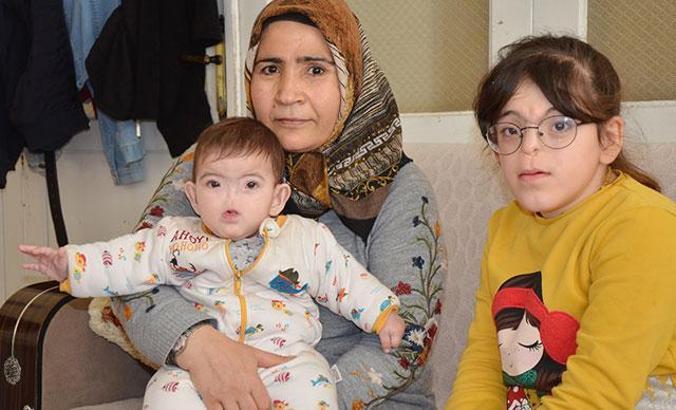 Doğuştan burunsuz dünyaya gelen Amine ve kardeşi Erva aynı kaderi paylaşıyor