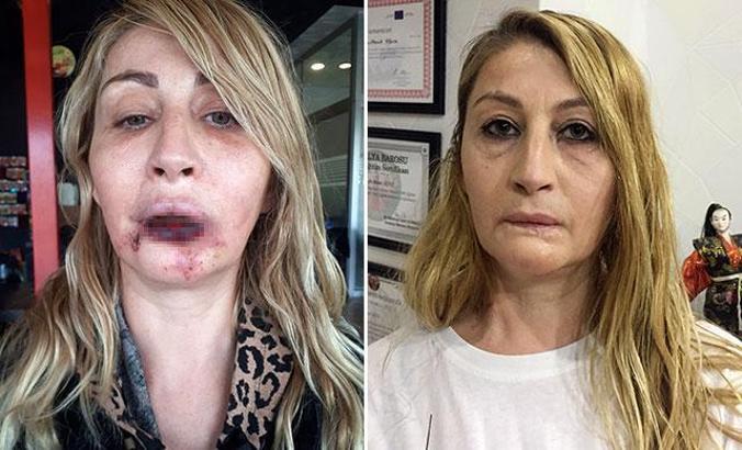 'Estetik mağduru kadınlar, toplumun önyargısından çekinerek, öne çıkamıyor'