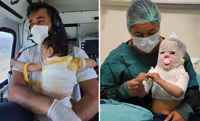 Bakan Koca: Beril bebeğin durumu iyi, tedavisi devam ediyor