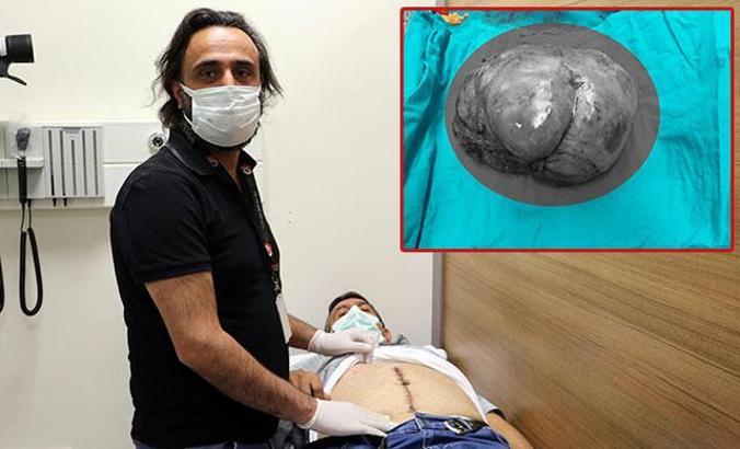 Ağrıyla gitti, karnından 6 kiloluk tümör çıkarıldı