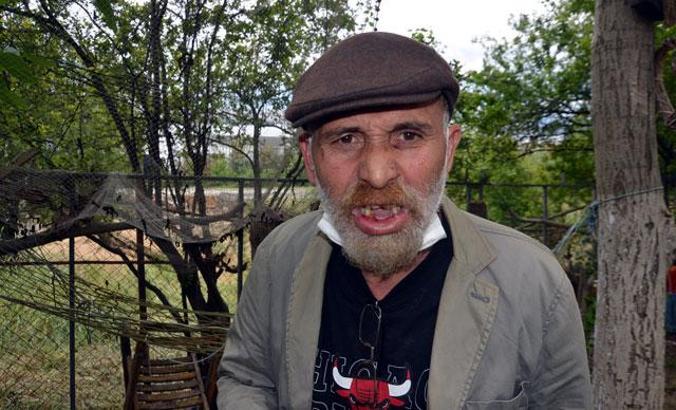 Komşu kavgasında tiyatrocunun keserle 3 dişi kırıldı