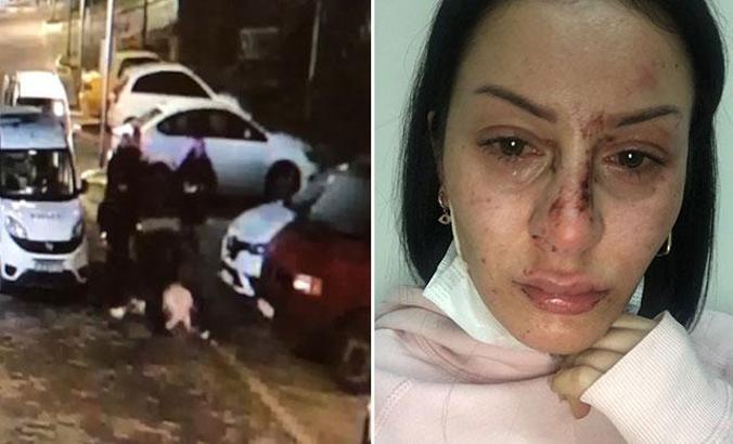 Polisin dövdüğü kadına emniyet müdüründen çiçek