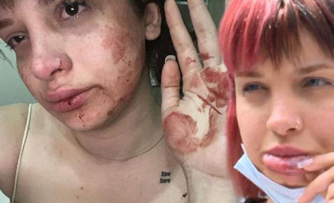 Sosyal medya fenomenine tayt dayağı: Başıma gelmesine şaşırmadım