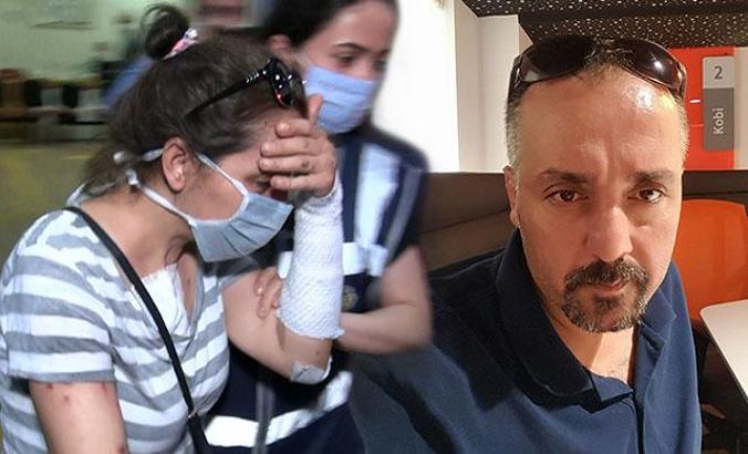 Eski erkek arkadaşının yüzüne kezzap atan kadına tahliye