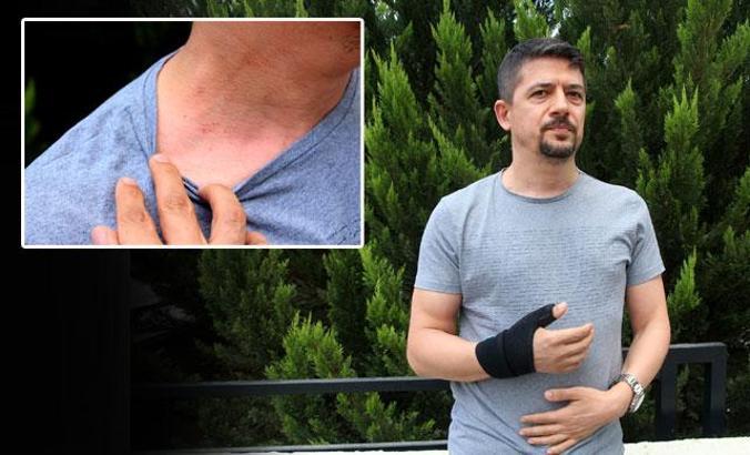 Trafikte yol verme kavgasında doktora dayak