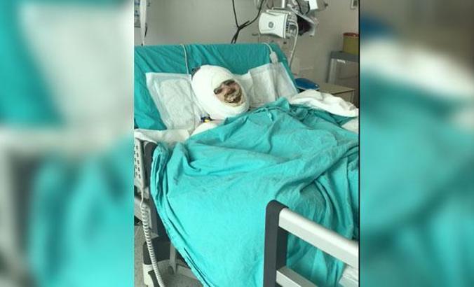 Benzin döküp evi ateşe verdi; alevlerin arasında kalan kayınvalidesi yaralandı