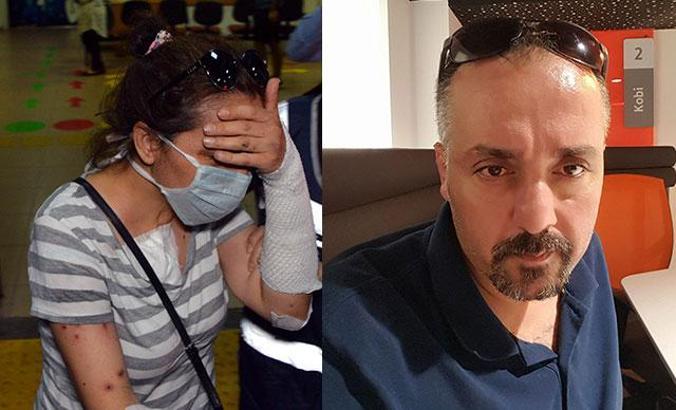 Eski kız arkadaşı yüzüne kezzap atmıştı, evinde ölü bulundu