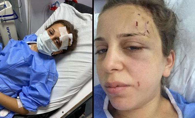 Eski eşinin 5 saat şiddet uyguladığı kadın: Kızımı da alıp kaçtı