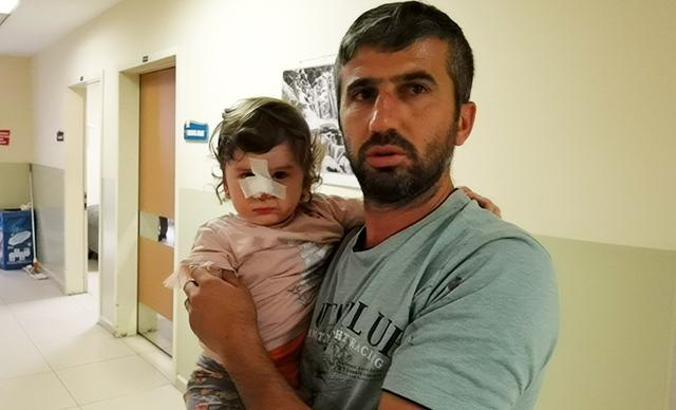 2 yaşındaki Zeliha'ya saldıran köpeğin sahibi aranıyor