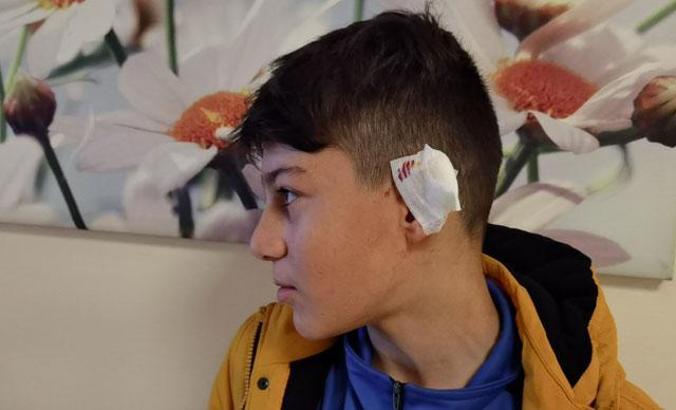 Alman çoban köpeğinin saldırdığı Yusuf'un kulağında doku kaybı var