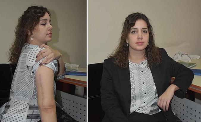 Sevgilisinin kolunu kıran sanığa tahrik ve iyi hal indirimi