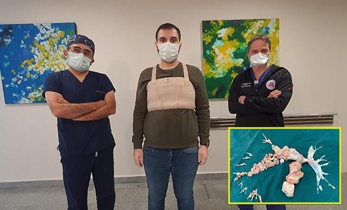 Kovid'e bağlı pıhtı sanıldı, ameliyatta ortaya çıkan gerçek doktorları bile şaşırttı
