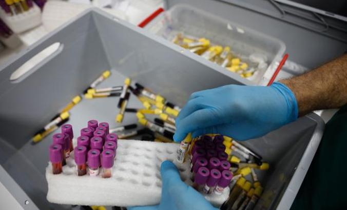 İSLAB Projesi ile İstanbul'un tüm testleri tek çatı altında